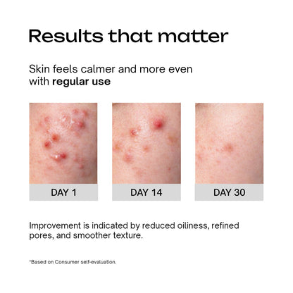Niacinamide 5% Betaine 3% Serum