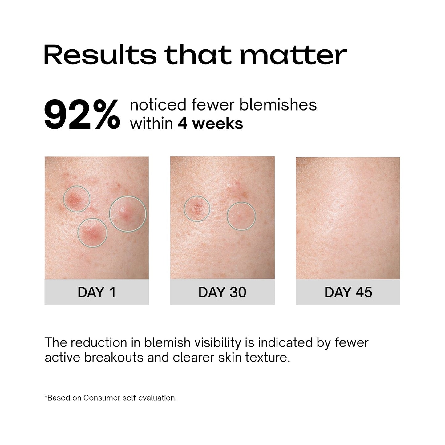 Salicylic Acid 2% + Tranexamic Acid 2% Serum
