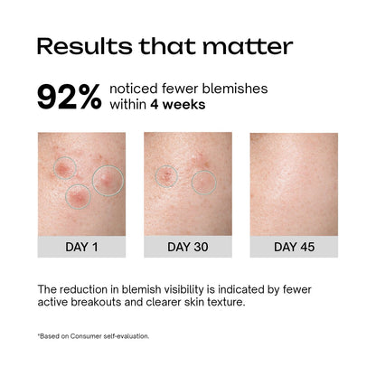 Salicylic Acid 2% + Tranexamic Acid 2% Serum