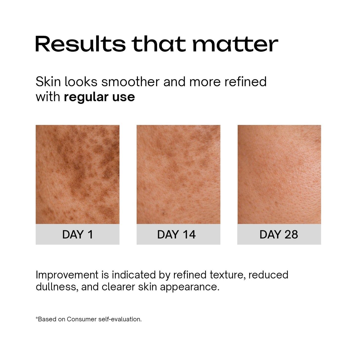 8% Glycolic Acid + 1% Salicylic Acid + 1% GDL Multipurpose Toning Solution
