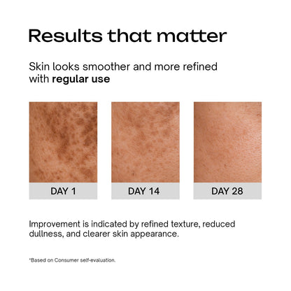 8% Glycolic Acid + 1% Salicylic Acid + 1% GDL Multipurpose Toning Solution