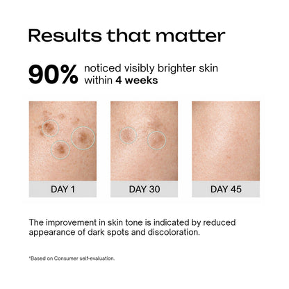 Kojic Acid 2% + Peptide 1% Serum