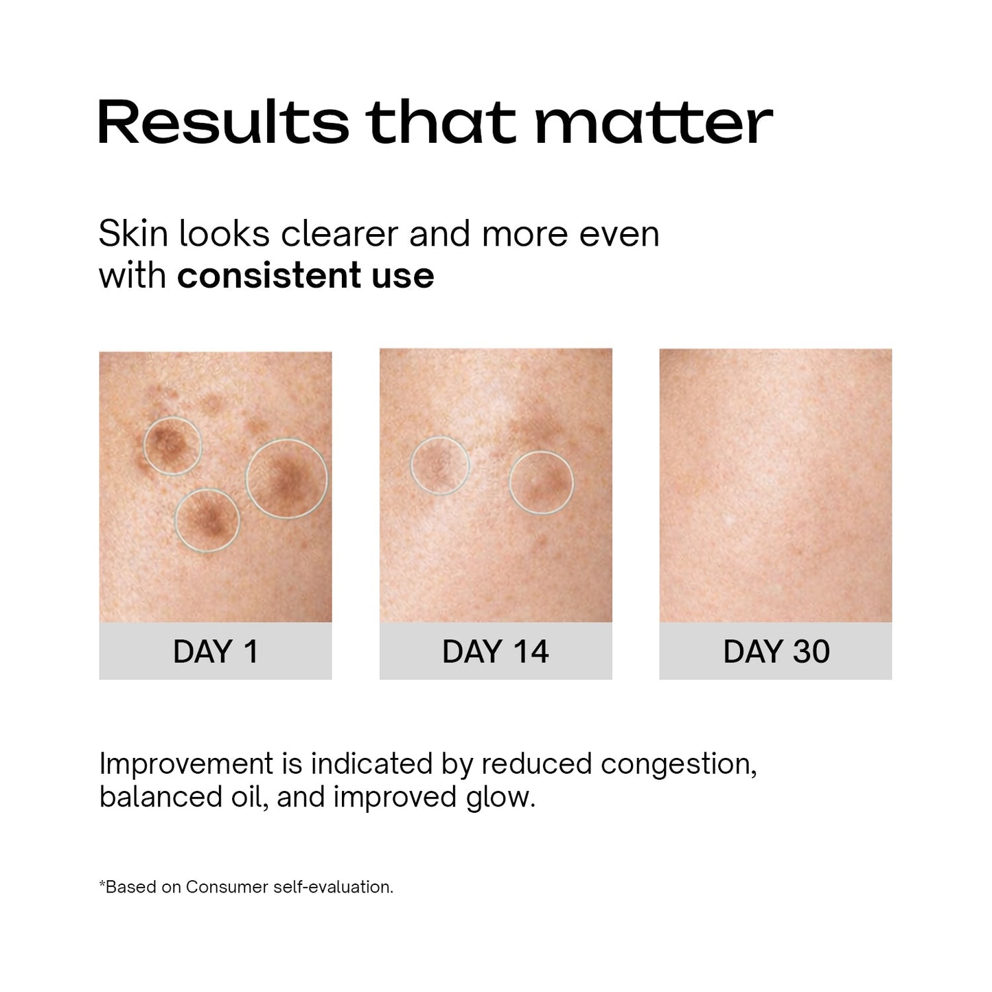 Glow and Acne Clear Face Moisturiser