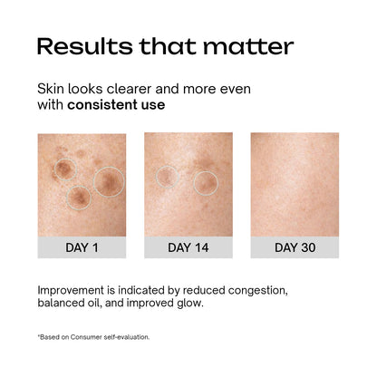 Glow and Acne Clear Face Moisturiser