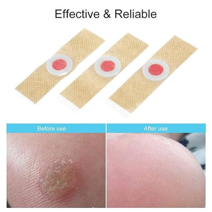 Corn Remover Pads Pack of 24